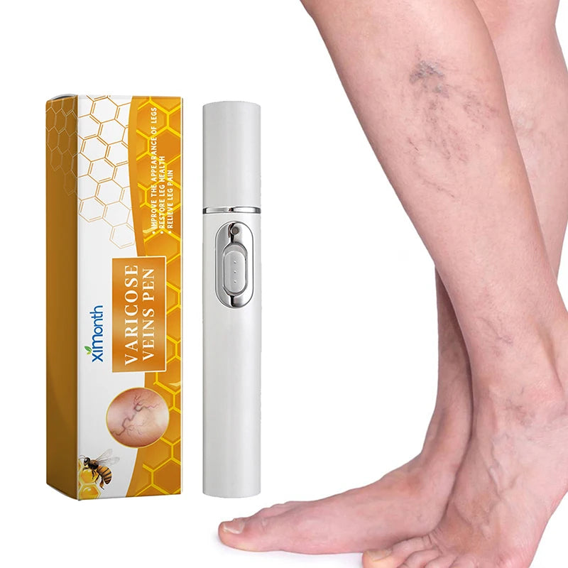 VeinErase Pro - Blue Light Laser for Varicose Vein Removal